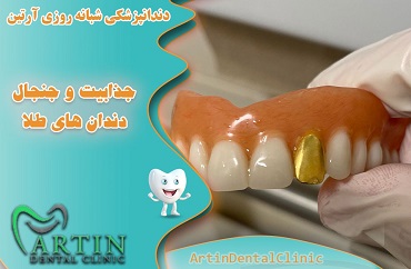 جذابیت و جنجال دندانهای طلا