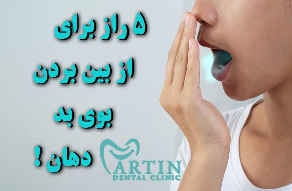 5 راز برای از بین بردن بوی بد دهان !
