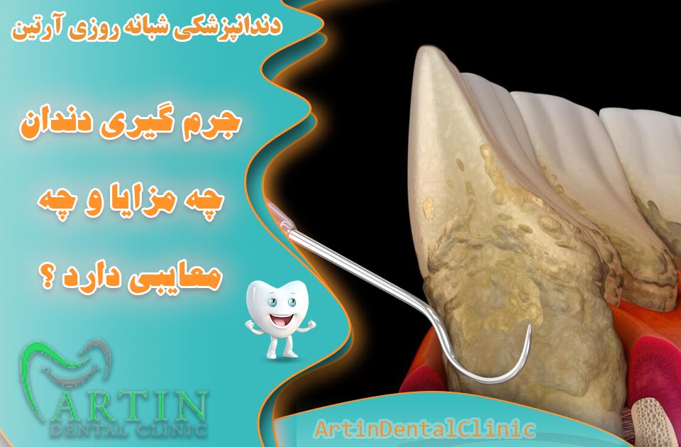 جرم گیری دندان چه مزایا و چه معایبی دارد ؟