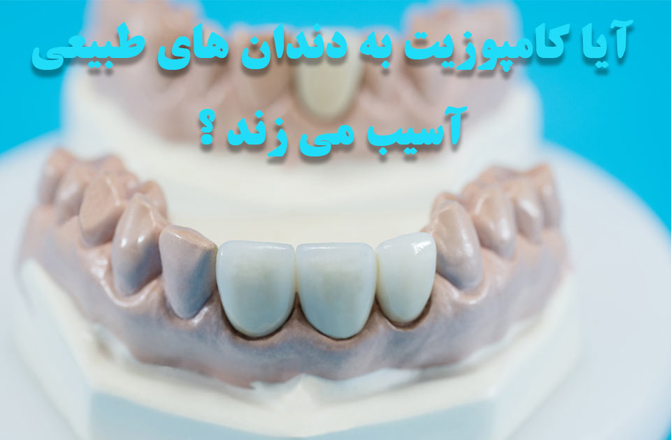 آیا کامپوزیت به دندان های طبیعی آسیب می زند ؟