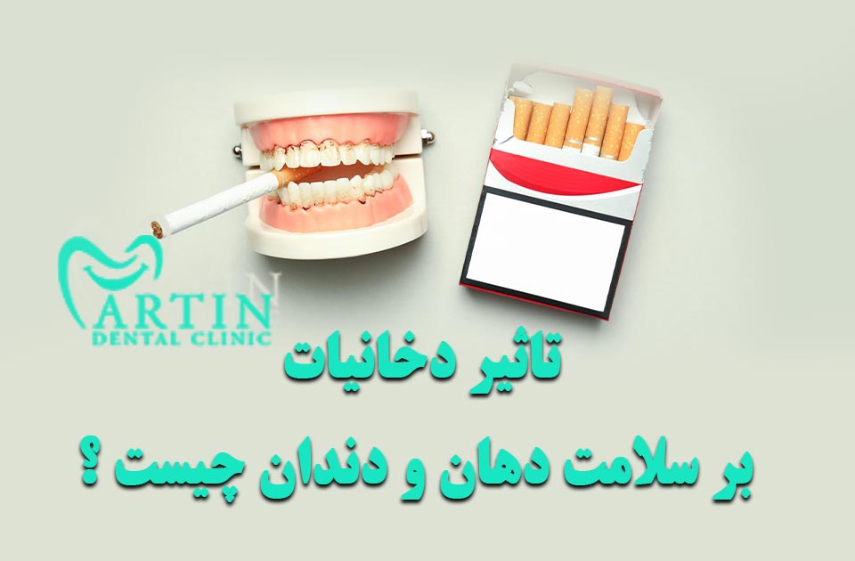 تاثیر دخانیات بر سلامت دهان و دندان چیست ؟