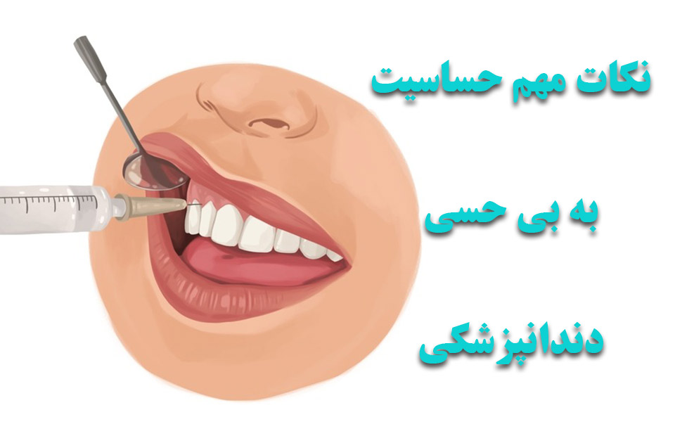 نکات مهم حساسیت به بی حسی دندانپزشکی