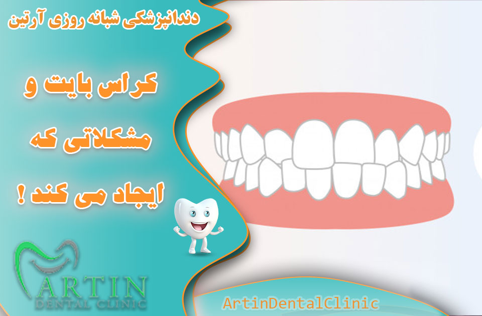 کراس بایت چیست و چه مشکلاتی دارد ؟