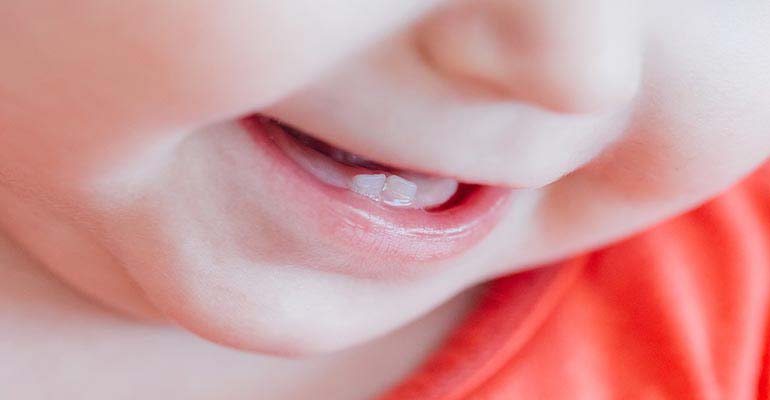 علائم دندان در آوردن چیست؟