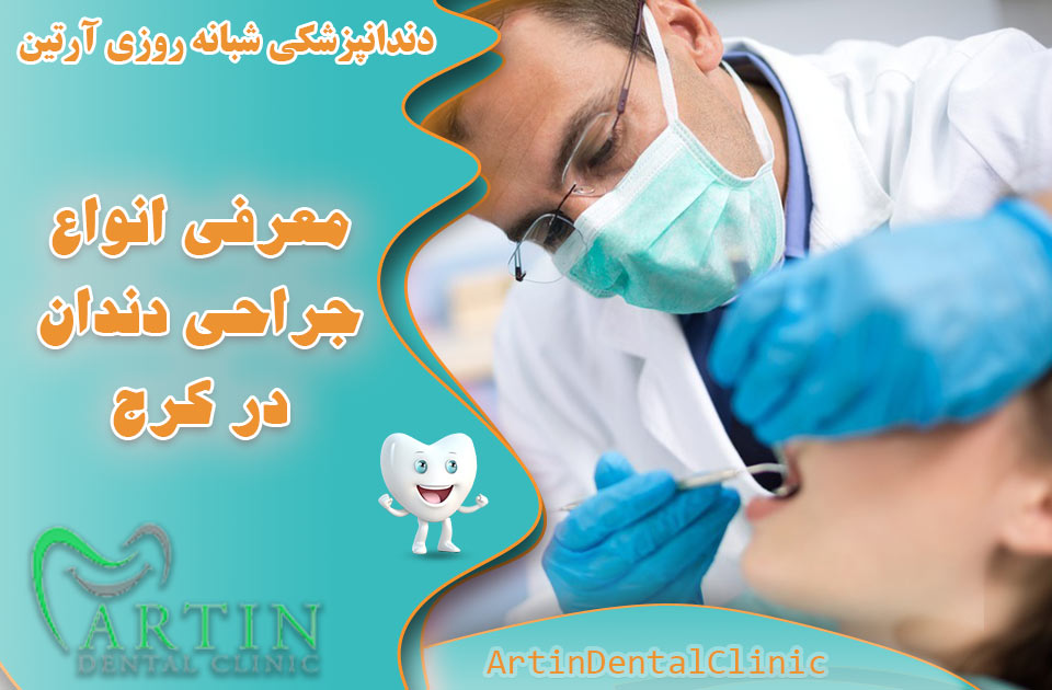 معرفی انواع جراحی دندان در کرج