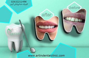 ترمیم و سفید کردن دندان